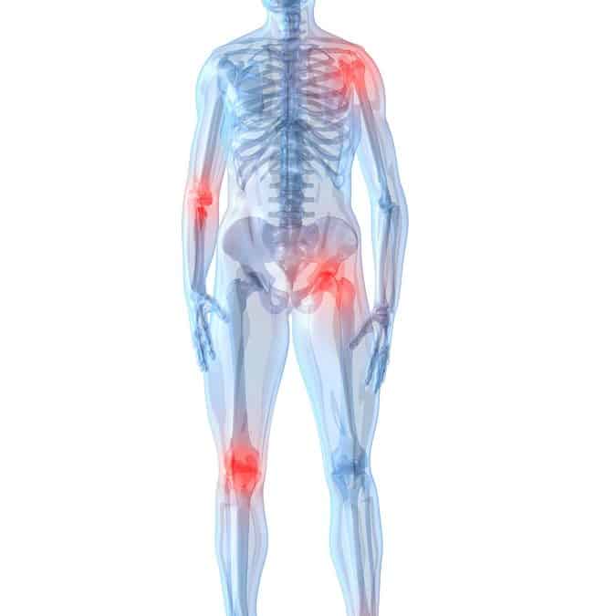 Reducing Joint Pain Without Surgery