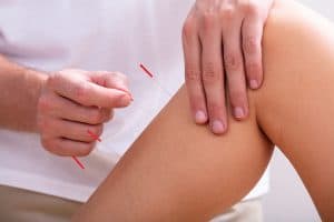acupuncture on lower leg suggesting immunity protocol